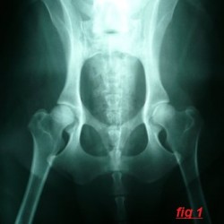 hip normal - web small